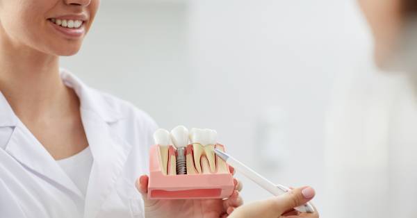 5 Common Myths and Facts About Dental Implants in Garland 5 Common Myths and Facts About Dental Implants in Garland