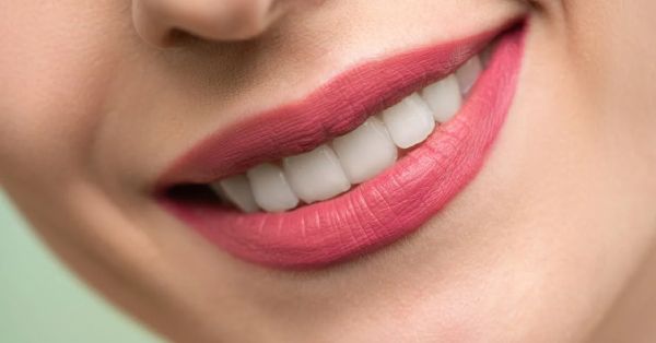 A Comprehensive Guide to Teeth Whitening in Garland