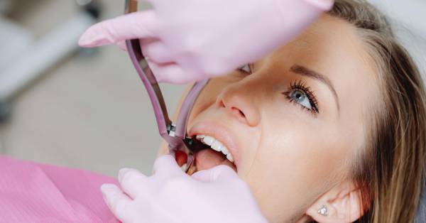 How Tooth Extractions in Garland Can Improve Your Oral Health